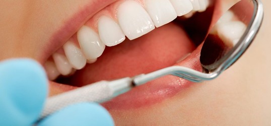 Restauração dentária três faces e outros procedimentos